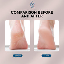 Load image into Gallery viewer, Electric Foot File for Heels Grinding Tools